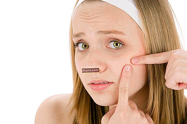 Come passa l'acne? Cosa è buono per le cicatrici da acne?