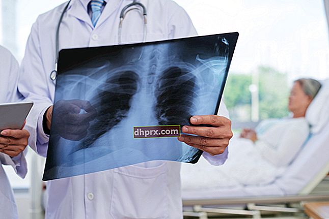 Cos'è la polmonite? Come diagnosticare e curare la polmonite?