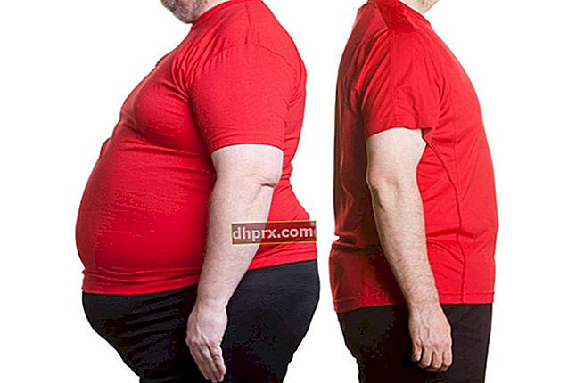 7 Cara Mengatasi Obesitas